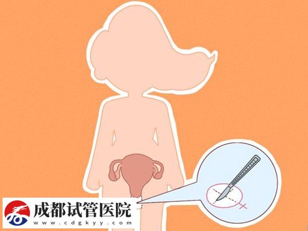 什么是始基子宫？始基子宫的治疗方法有哪些？(图5)